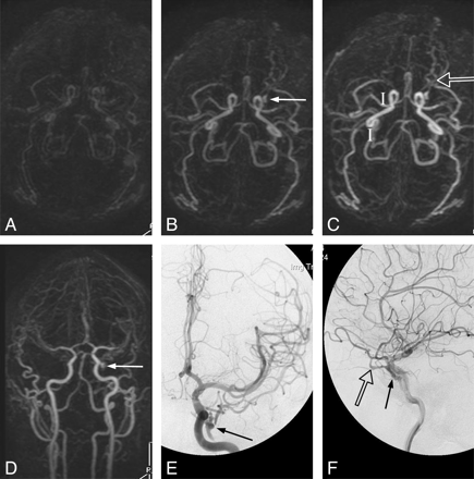 Fig 5.