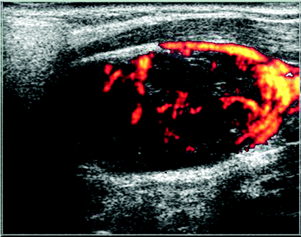 Fig 1.