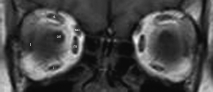 Fig 2.