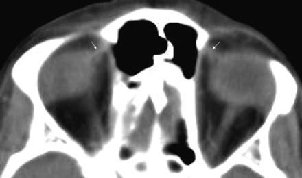 Fig 3.