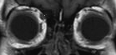 Fig 4.