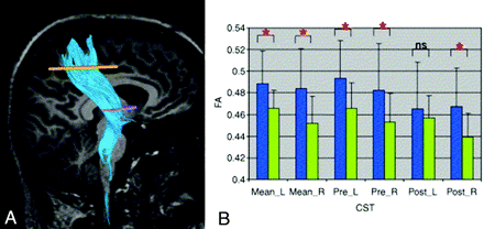 Fig 3.