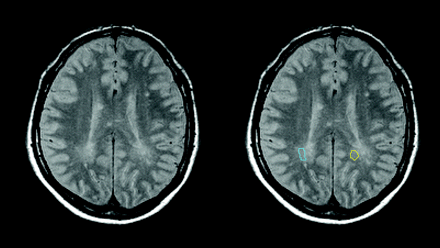 Fig 3.