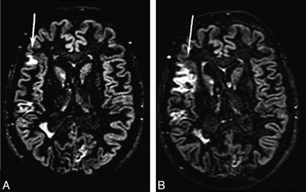 Fig 1.
