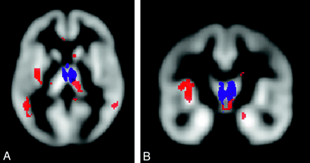 Fig 3.