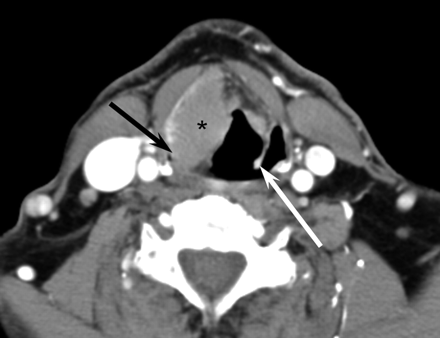 Fig 3.