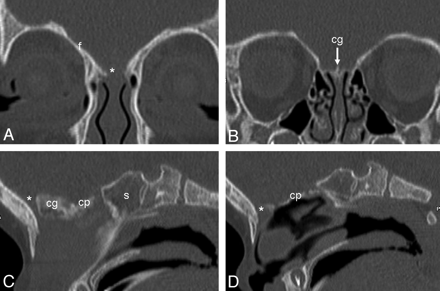 Fig 7.