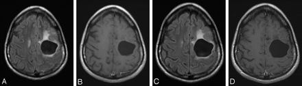 Fig 2.