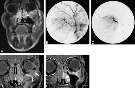 Fig 4.