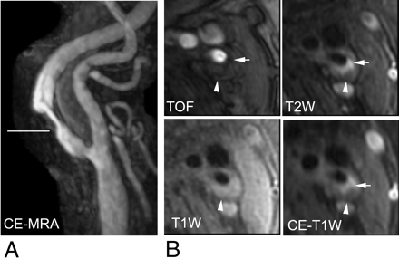 Fig 2.