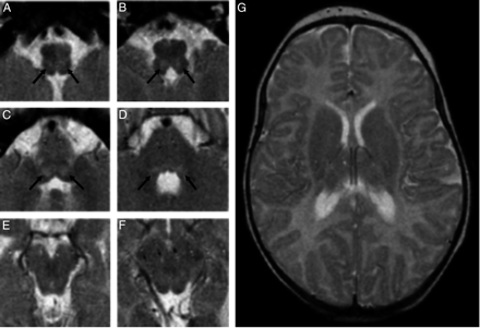Fig 1.