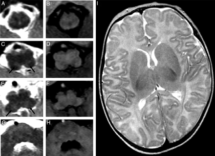 Fig 2.