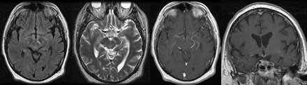 Fig 1.