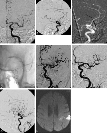 Fig 1.