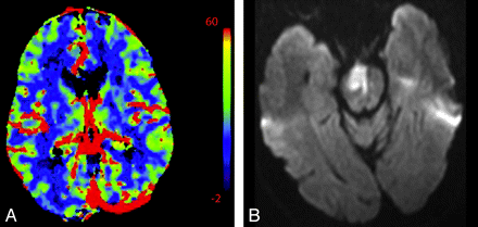 Fig 6.