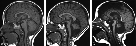 Fig 2.