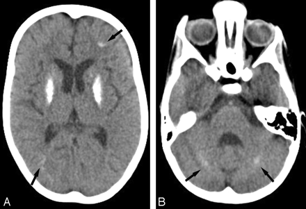 Fig 1.