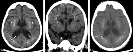 Fig 2.