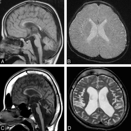 Fig 3.