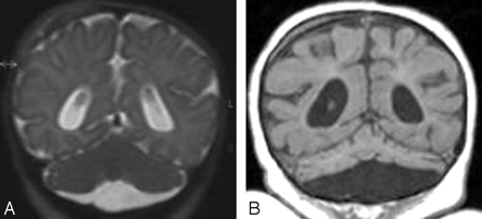Fig 4.