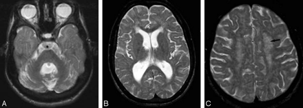 Fig 6.