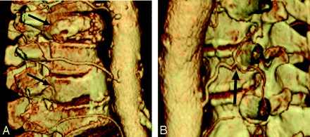 Fig 3.
