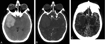 Fig 6.