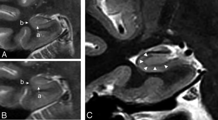 Fig 1.