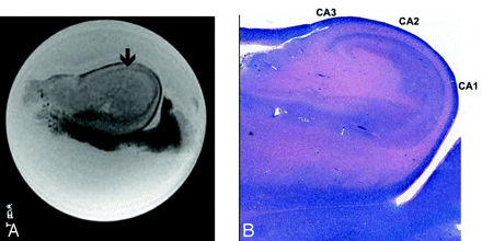 Fig 4.