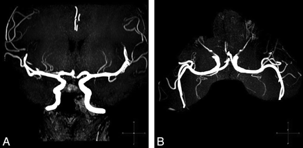 Fig 2.