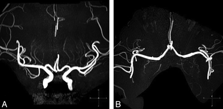 Fig 3.