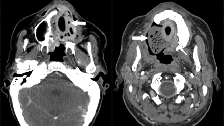 Fig 4.
