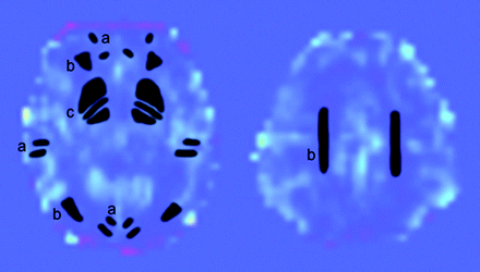 Fig 1.
