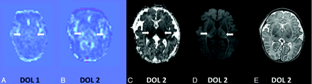 Fig 4.