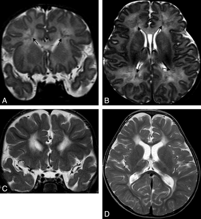 Fig 6.