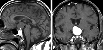 Fig 1.