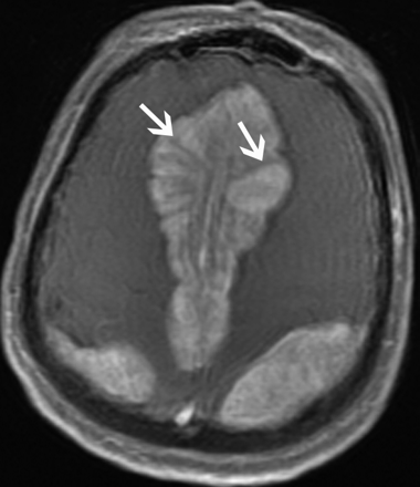 Fig 1.