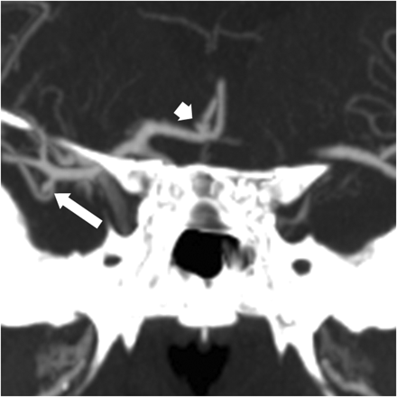 Fig 2.