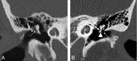 Fig 4.