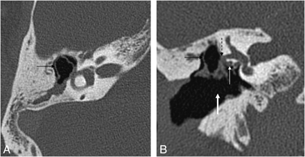 Fig 7.