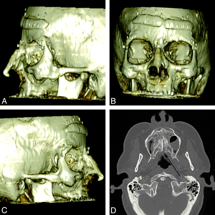 Fig 5.