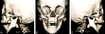 Fig 6.