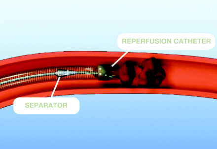 Fig 2.