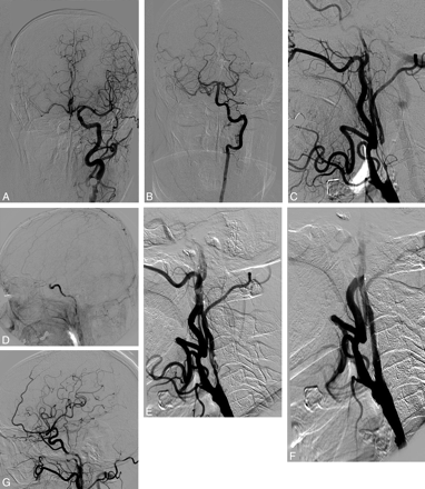 Fig 3.
