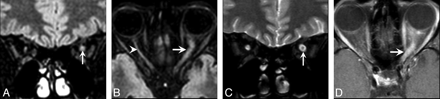 Fig 3.