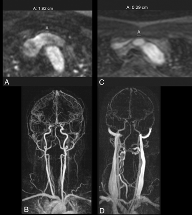 Fig 2.