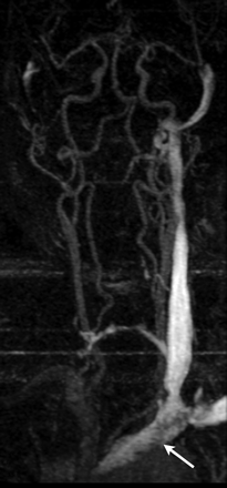 Fig 4.
