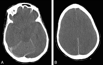 Fig 2.