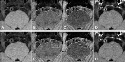 Fig 1.