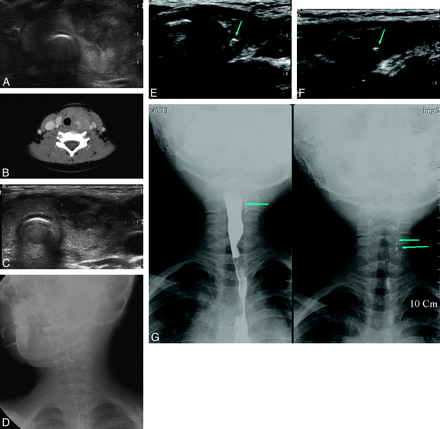 Fig 1.